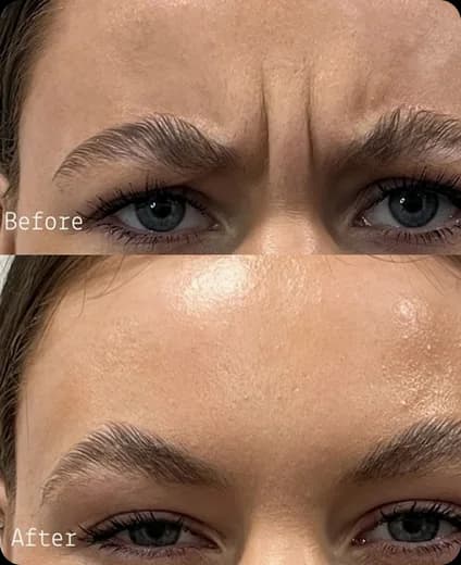 Ren Aesthetics & Wellness treatment gallery