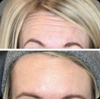 Ren Aesthetics & Wellness treatment gallery