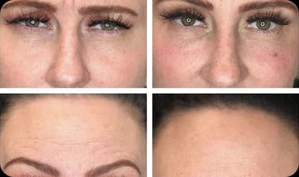 Ren Aesthetics & Wellness treatment gallery